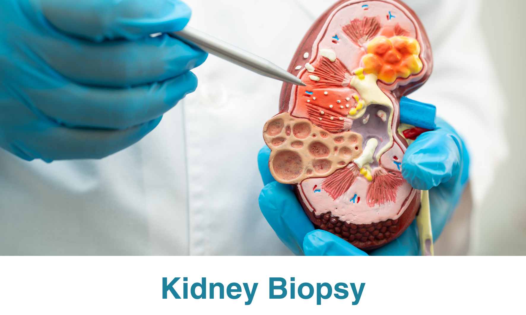 Kidney Biopsy