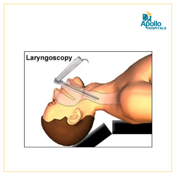 What are the uses of laryngoscopy?
