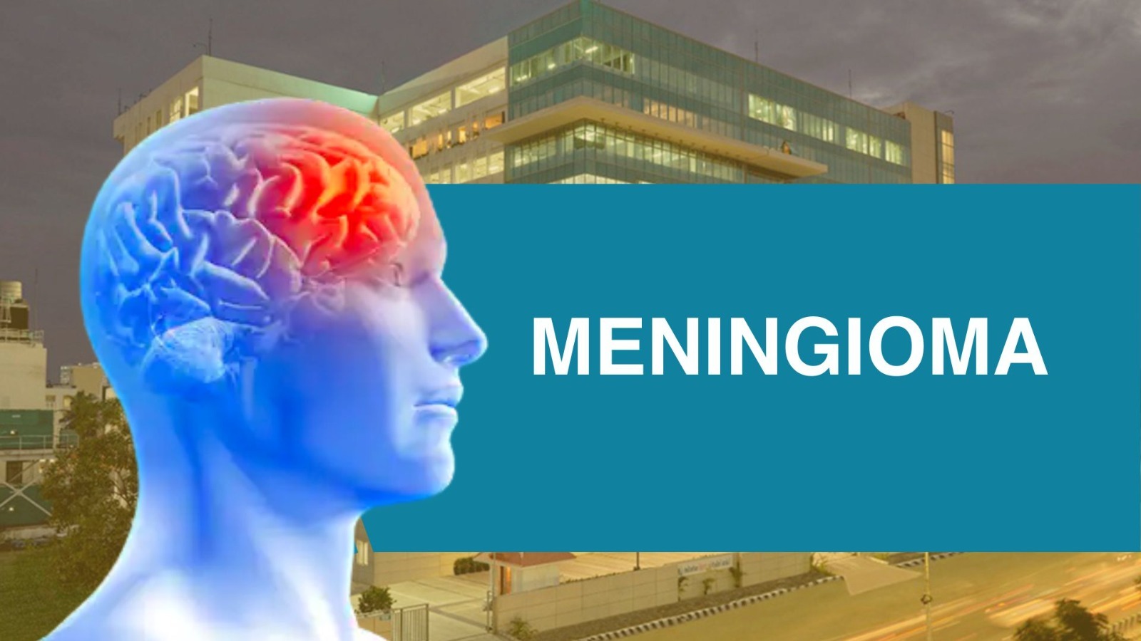 Meningioma: Causes, Symptoms, and Treatment