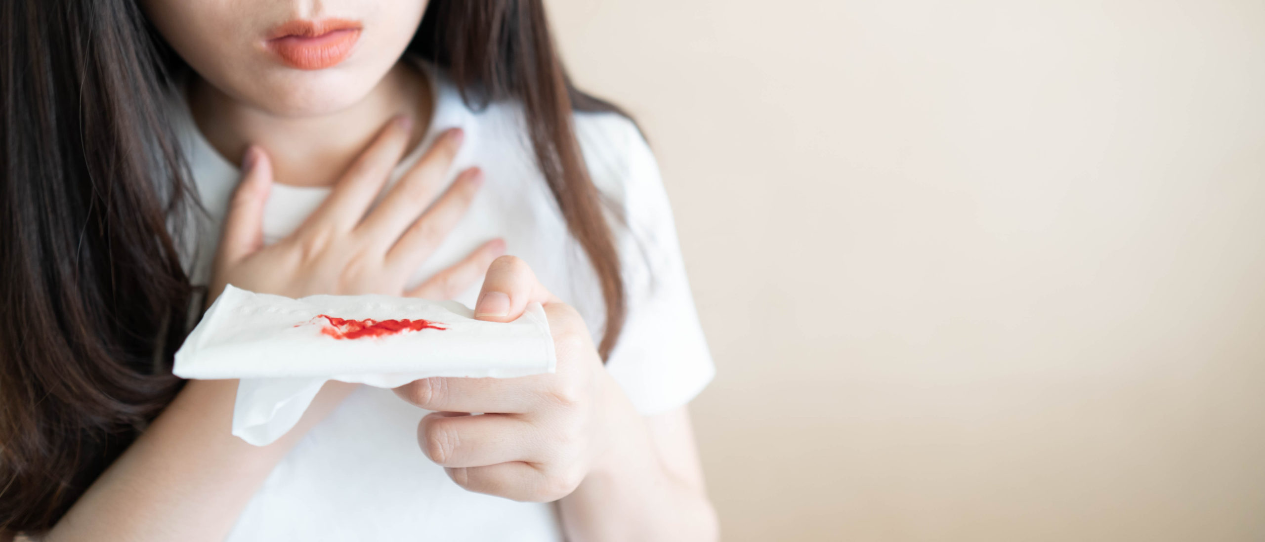 What is Hemoptysis (Coughing up Blood)? What is Hemoptysis (Coughing up Blood)?