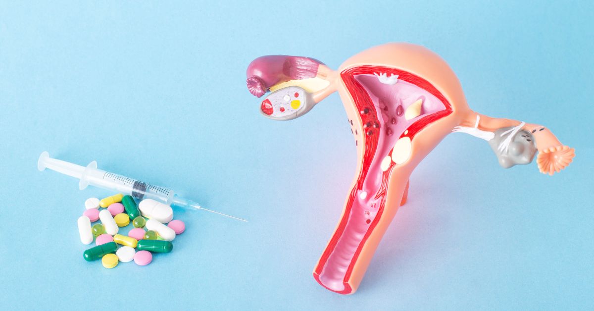 Trichomoniasis: Causes, Symptoms, Diagnosis and Treatment