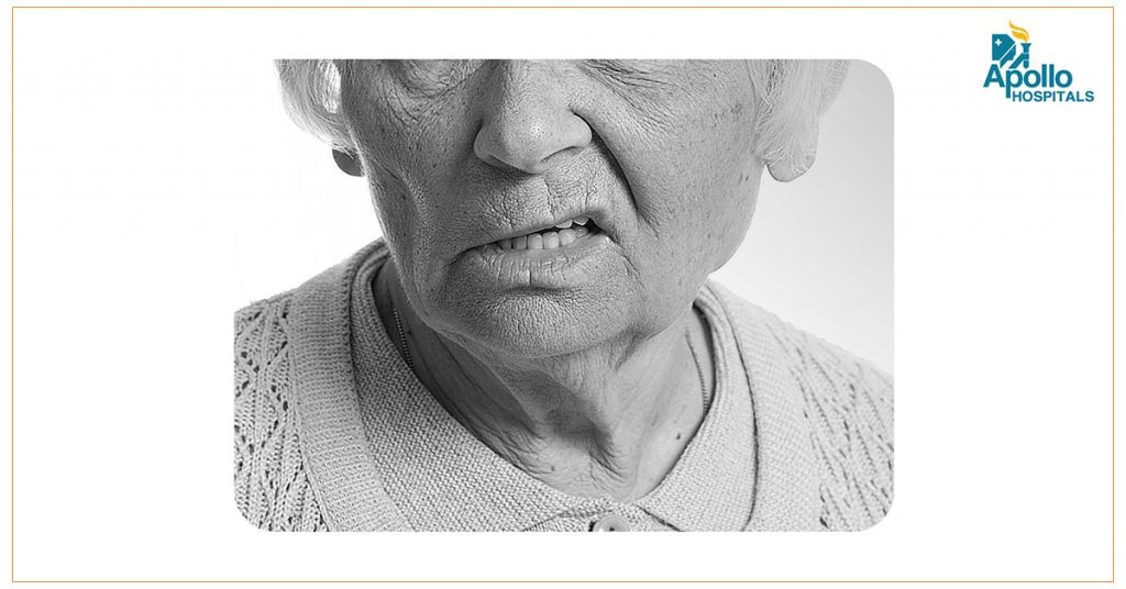 Stroke first aid: Think FAST Call 1066