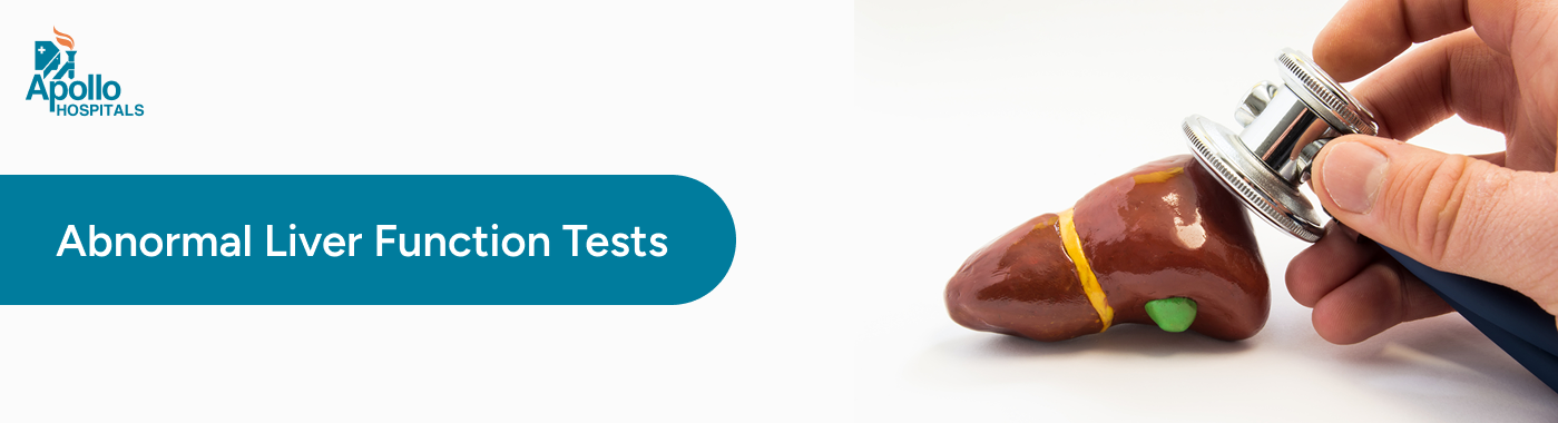 Abnormal Liver Function Tests