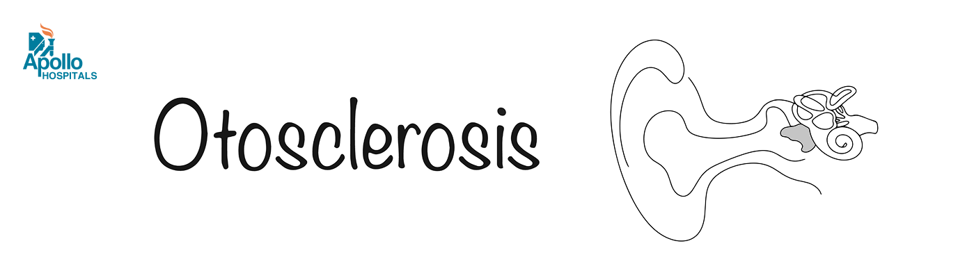 Otosclerosis