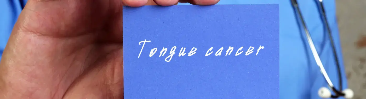 Tongue Cancer - Early Signs, Risk Factors, Diagnosis, and Treatment Explained