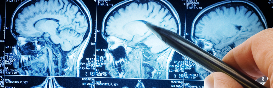 04_neurology-and-neurosurgery_banner_925x300.jpg