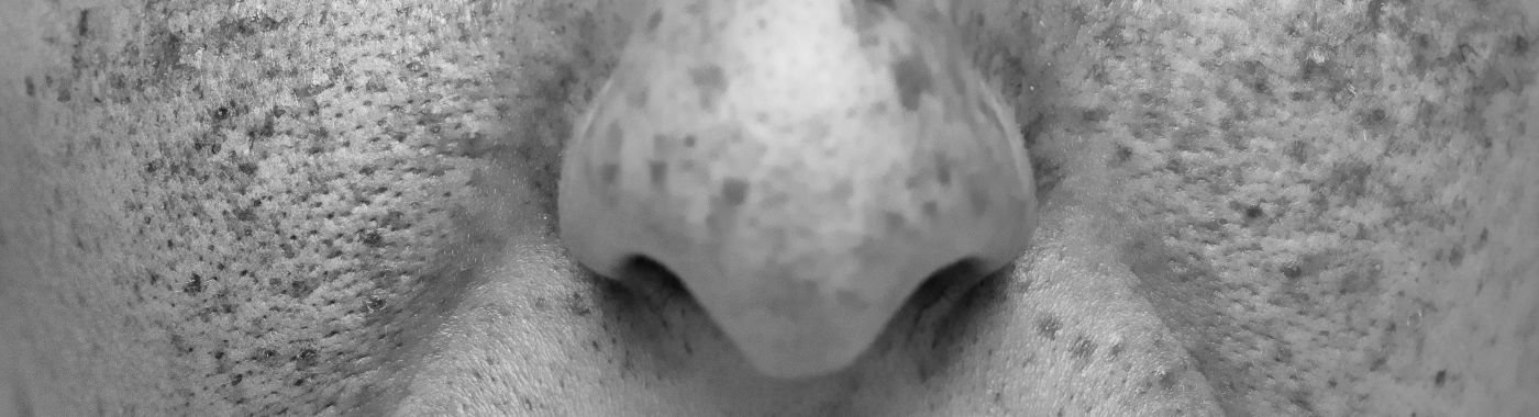 Actinic Cheilitis - Causes, Symptoms, Diagnosis, Treatment, and Prevention