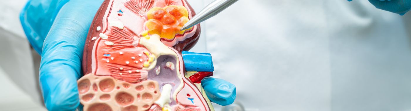 https:/www.apollohospitals.com/diseases-and-conditions/acute-tubular-necrosis