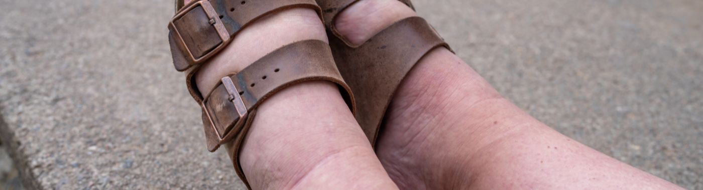 Anasarca - Causes, Symptoms, Diagnosis, Treatment, and Prevention