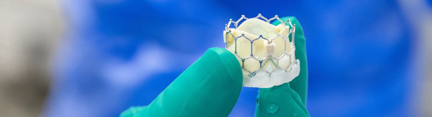 Aortic Stenosis - Causes, Symptoms, Diagnosis, Treatment, and Prevention