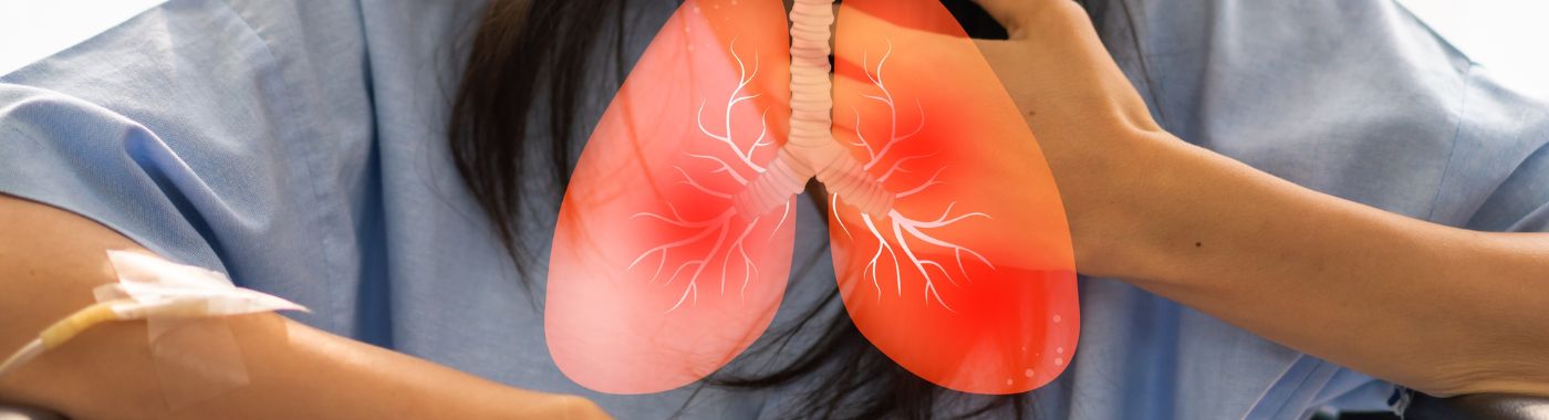 Aspiration Pneumonia - Causes, Symptoms, Diagnosis, Treatment, and Prevention