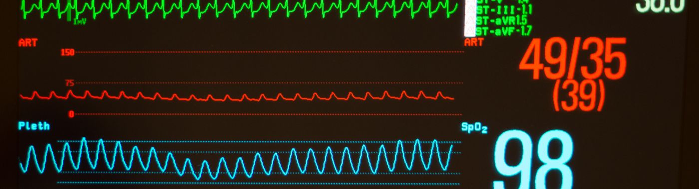 Avnrt - Causes, Symptoms, Diagnosis, Treatment, and Prevention