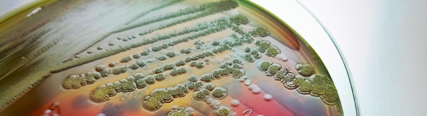 Bacteremia - Causes, Symptoms, Diagnosis, Treatment, and Prevention