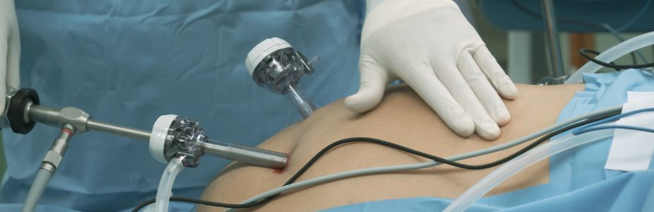 Bilio-Pancreatic Diversion (BPD)