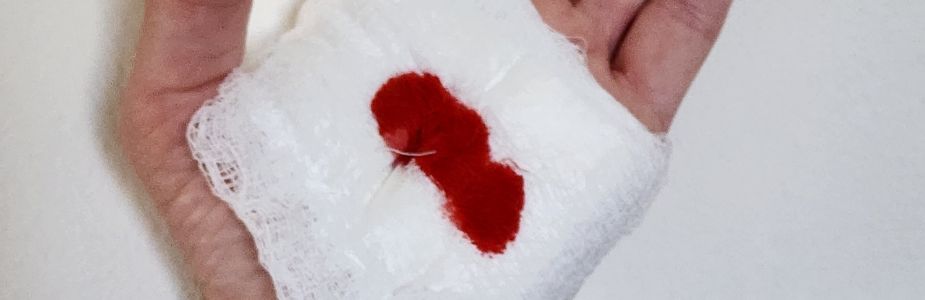 Bleeding Control / Haemostasis (Upper/Lower GI)