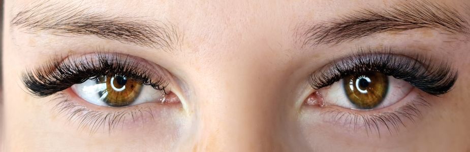 Brow / Forehead Lift