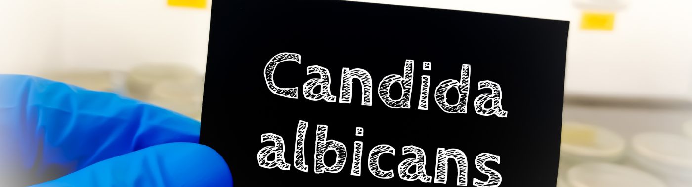 Candida Albicans - Causes, Symptoms, Diagnosis, Treatment, and Prevention
