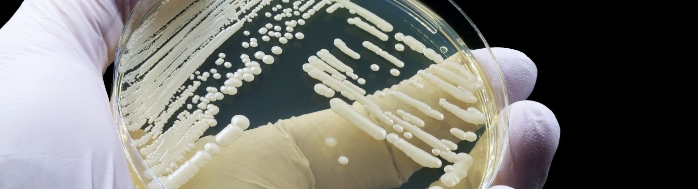 Candida Auris - Causes, Symptoms, Diagnosis, Treatment, and Prevention