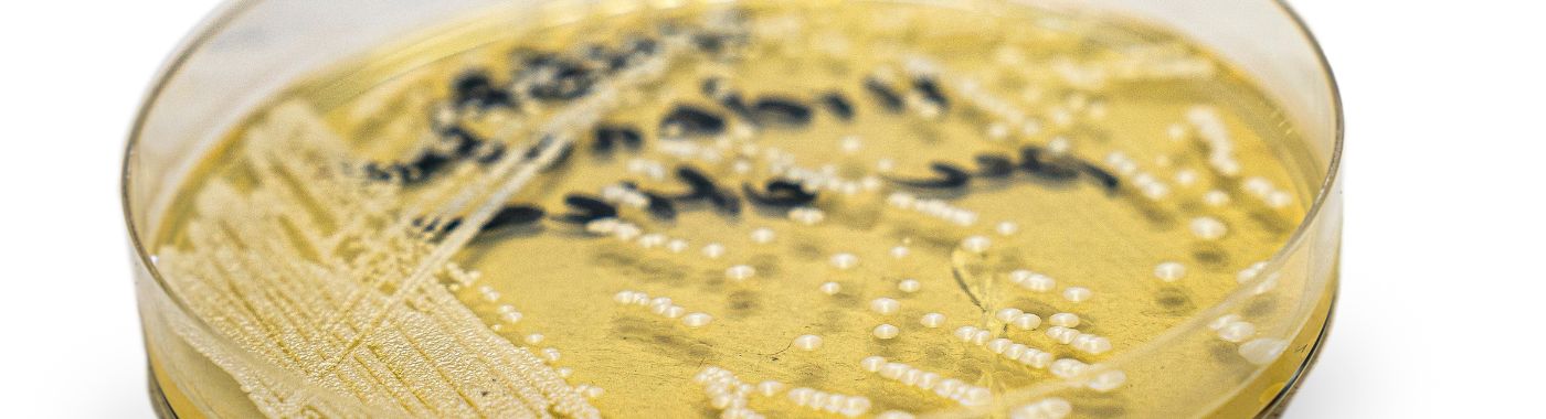 Candida Parapsilosis - Causes, Symptoms, Diagnosis, Treatment, and Prevention