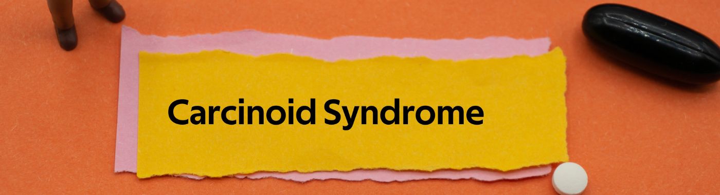 Carcinoid Syndrome - Causes, Symptoms, Diagnosis, Treatment, and Prevention