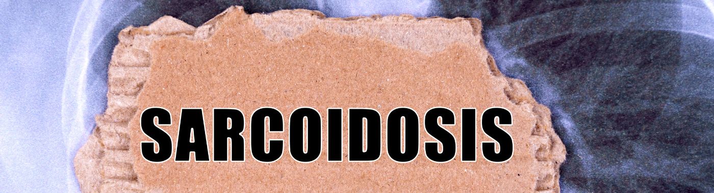 Cardiac Sarcoidosis - Causes, Symptoms, Diagnosis, Treatment, and Prevention