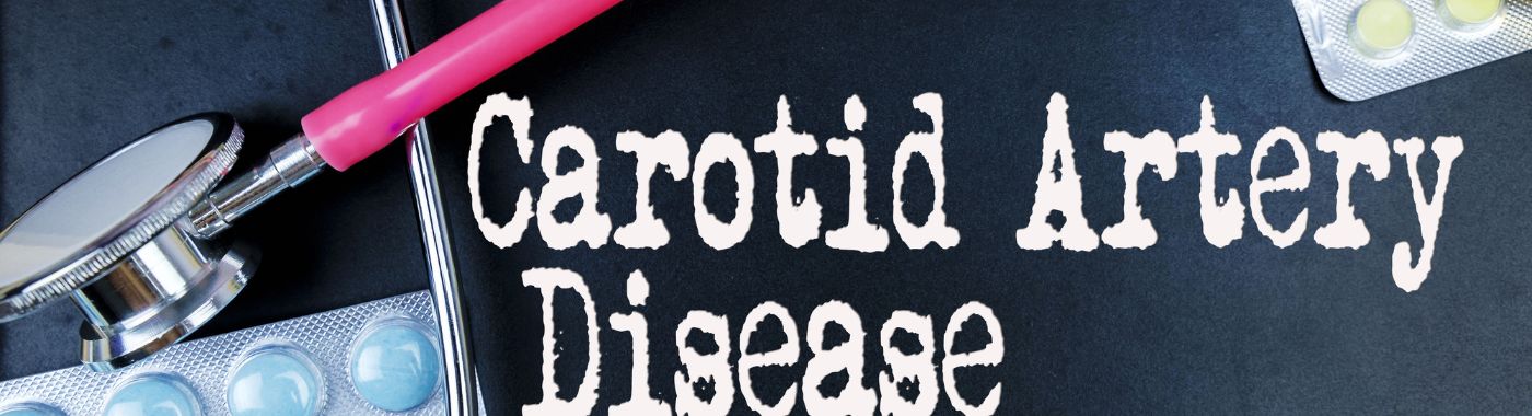 Carotid Artery Disease - Causes, Symptoms, Diagnosis, Treatment, and Prevention