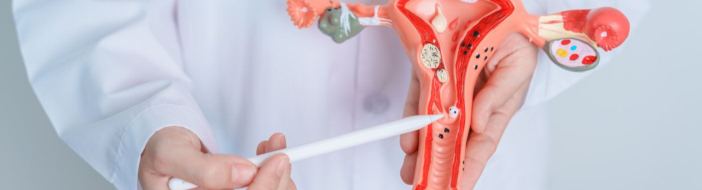 Cervical Polyp - Causes, Symptoms, Diagnosis, Treatment, and Prevention