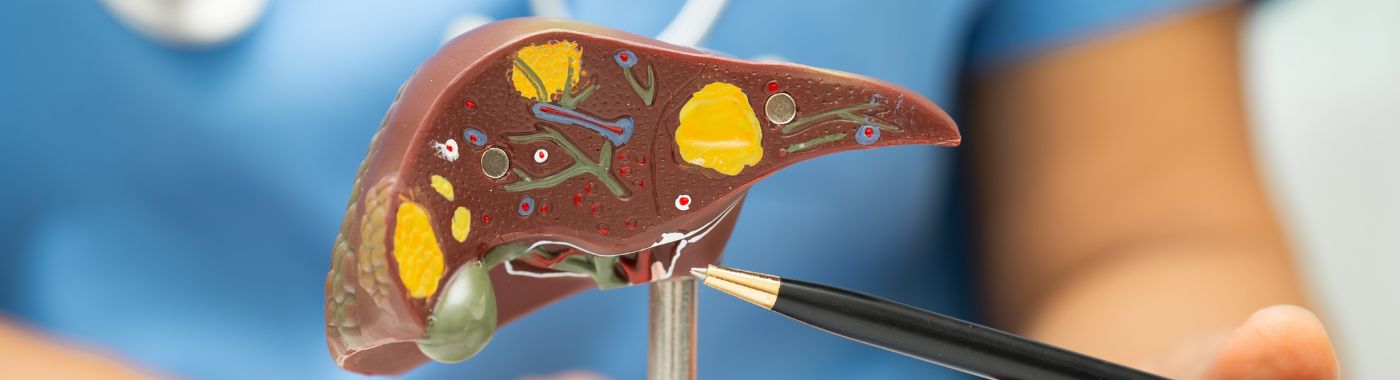 Cirrhosis of the liver