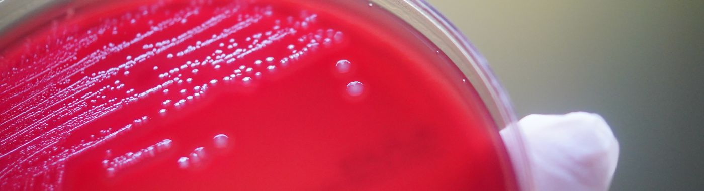 Clostridium Perfringens - Causes, Symptoms, Diagnosis, Treatment, and Prevention