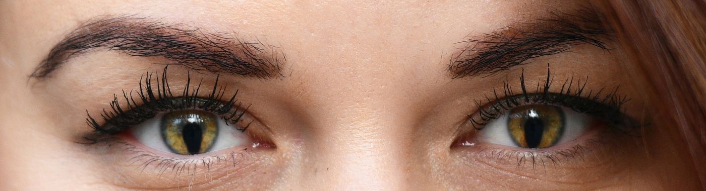 Coloboma - Causes, Symptoms, Diagnosis, Treatment, and Prevention