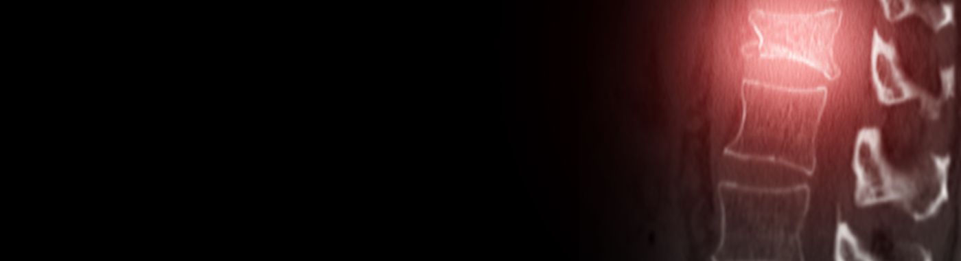 Compression Fractures - Causes, Symptoms, Diagnosis, Treatment, and Prevention