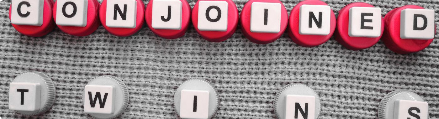 Conjoined Twins - Causes, Symptoms, Diagnosis, Treatment, and Prevention