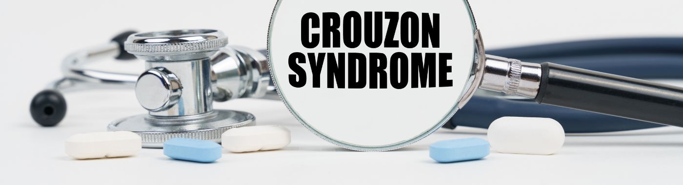 Crouzon Syndrome - Causes, Symptoms, Diagnosis, Treatment, and Prevention