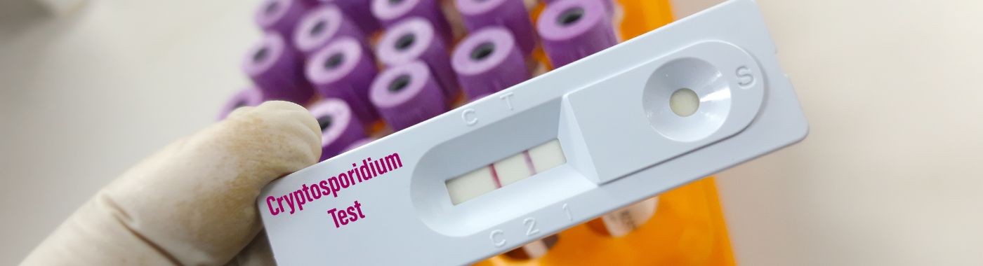 Cryptosporidiosis - Causes, Symptoms, Diagnosis, Treatment, and Prevention