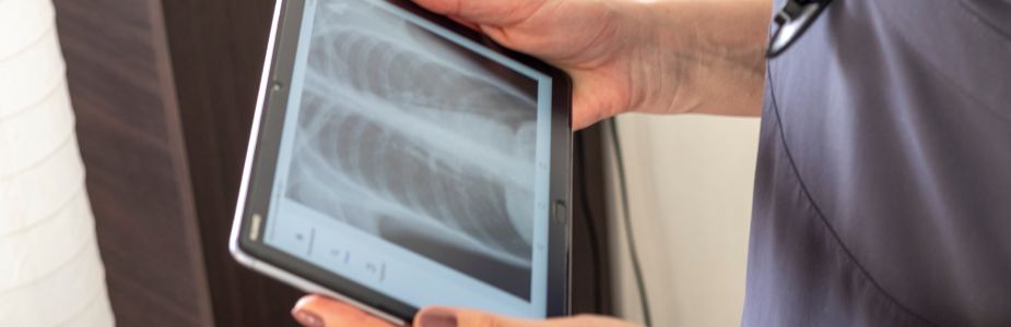 Endobronchial Ultrasound (EBUS)