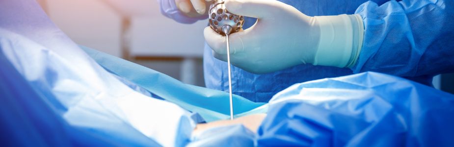 Endoscopic Spine Surgery