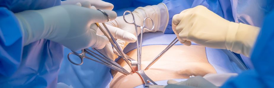 Hernia Repair (Inguinal / Umbilical / Diaphragmatic)