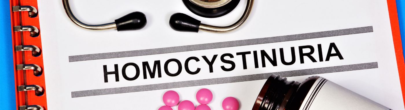 Homocystinuria - Causes, Symptoms, Diagnosis, Treatment, and Prevention