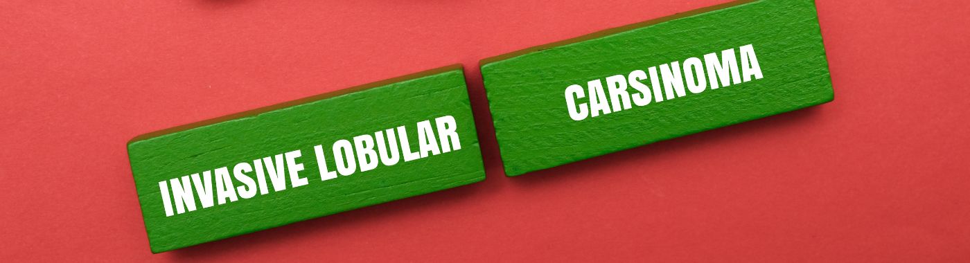 Invasive Lobular Carcinoma - Early Signs, Risk Factors, Diagnosis, and Treatment Explained