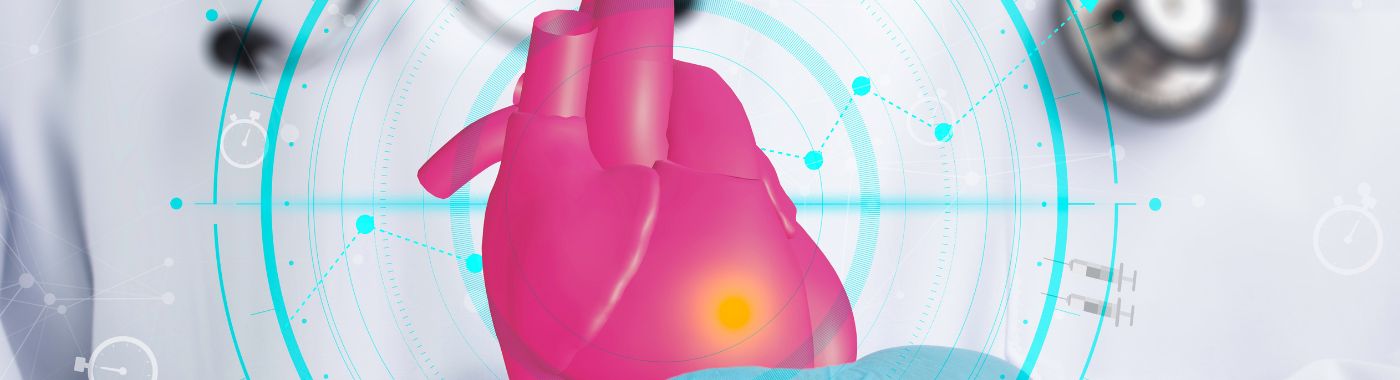 Myocardial infarction - Causes, Symptoms, Diagnosis, Treatment, and Prevention