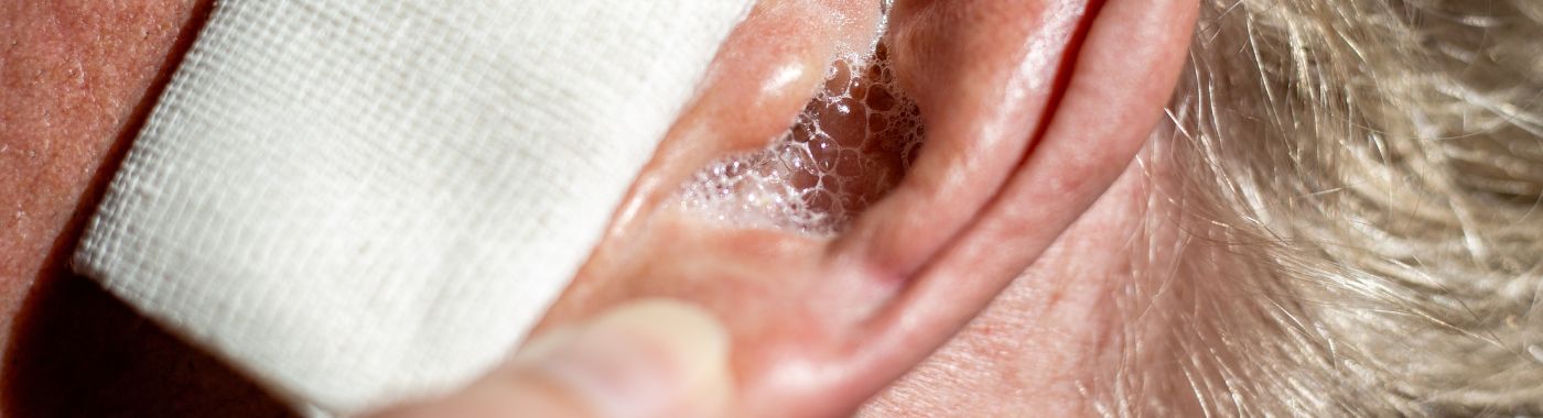 Otorrhea - Causes, Symptoms, Diagnosis, Treatment, and Prevention