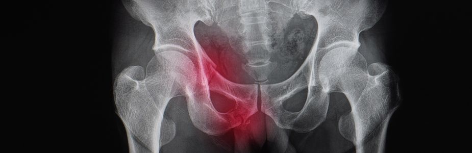 Pelvic Reconstructive / Prolapse Surgery