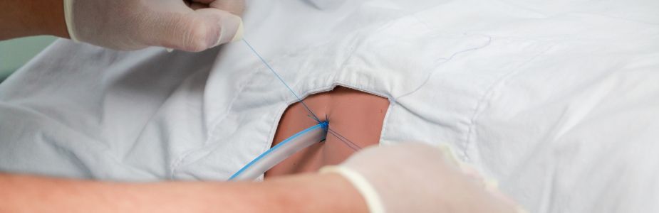 Pleural Drainage / Chest-Tube / Pleurodesis