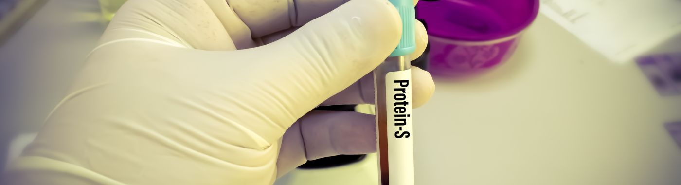 Protein S Deficiency - Causes, Symptoms, Diagnosis, Treatment, and Prevention