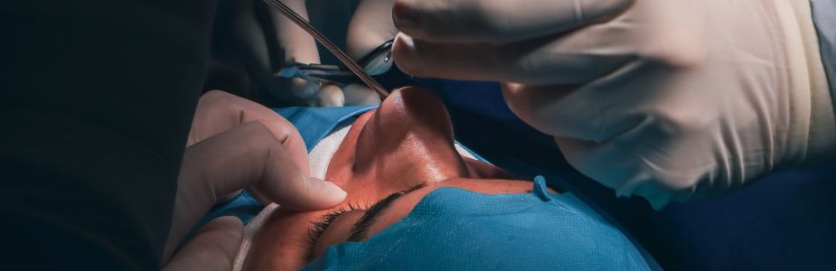 Rhinoplasty (Nose Reshaping)