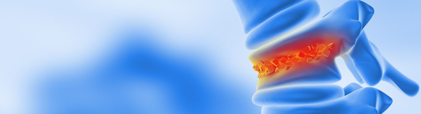 Spinal Fractures - Causes, Symptoms, Diagnosis, Treatment, and Prevention