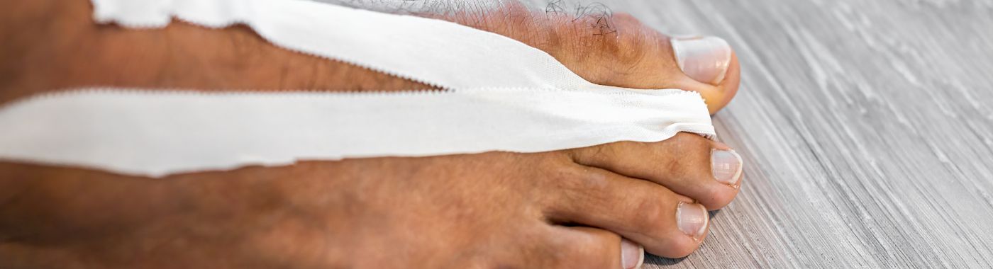 Turf Toe - Causes, Symptoms, Diagnosis, Treatment, and Prevention