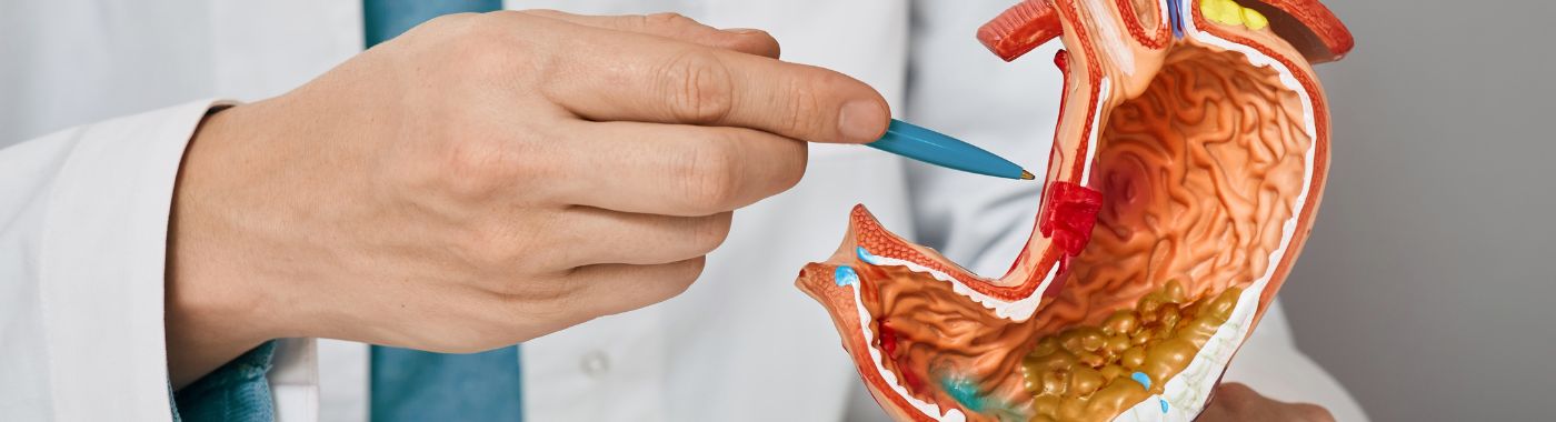 Ulcer - Causes, Symptoms, Diagnosis, Treatment, and Prevention