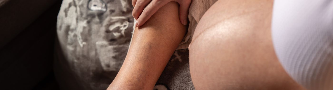 Varicose Veins In Pregnancy - Causes, Symptoms, Diagnosis, Treatment, and Prevention