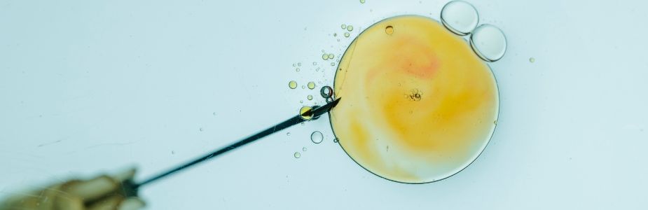 Assisted Reproductive Technologies (IVF / ICSI / ET)